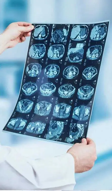 Radiologie numérisée générale et spécialisée